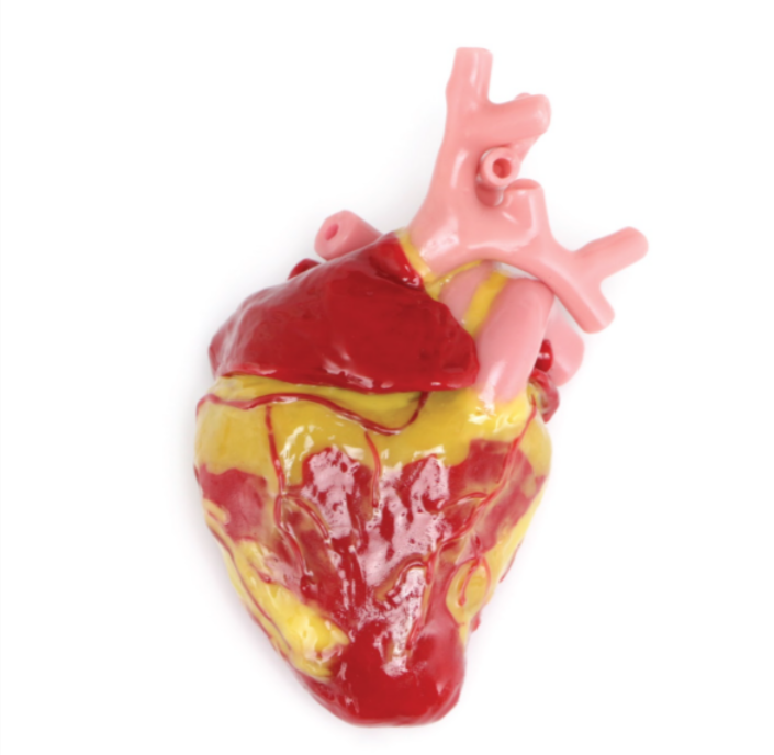 Anatomical Simulator for Heart Pathlogies