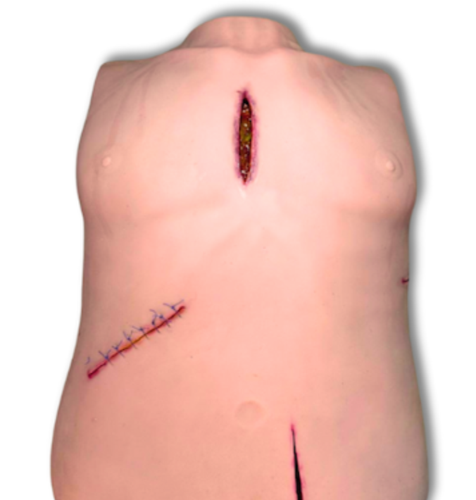 Lazarus Simulator for Wound Procedures