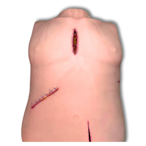 Lazarus Simulator for Wound Procedures