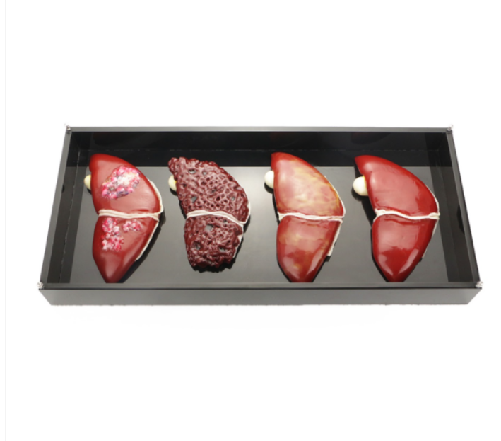 Anatomical Simulator for Liver Pathologies